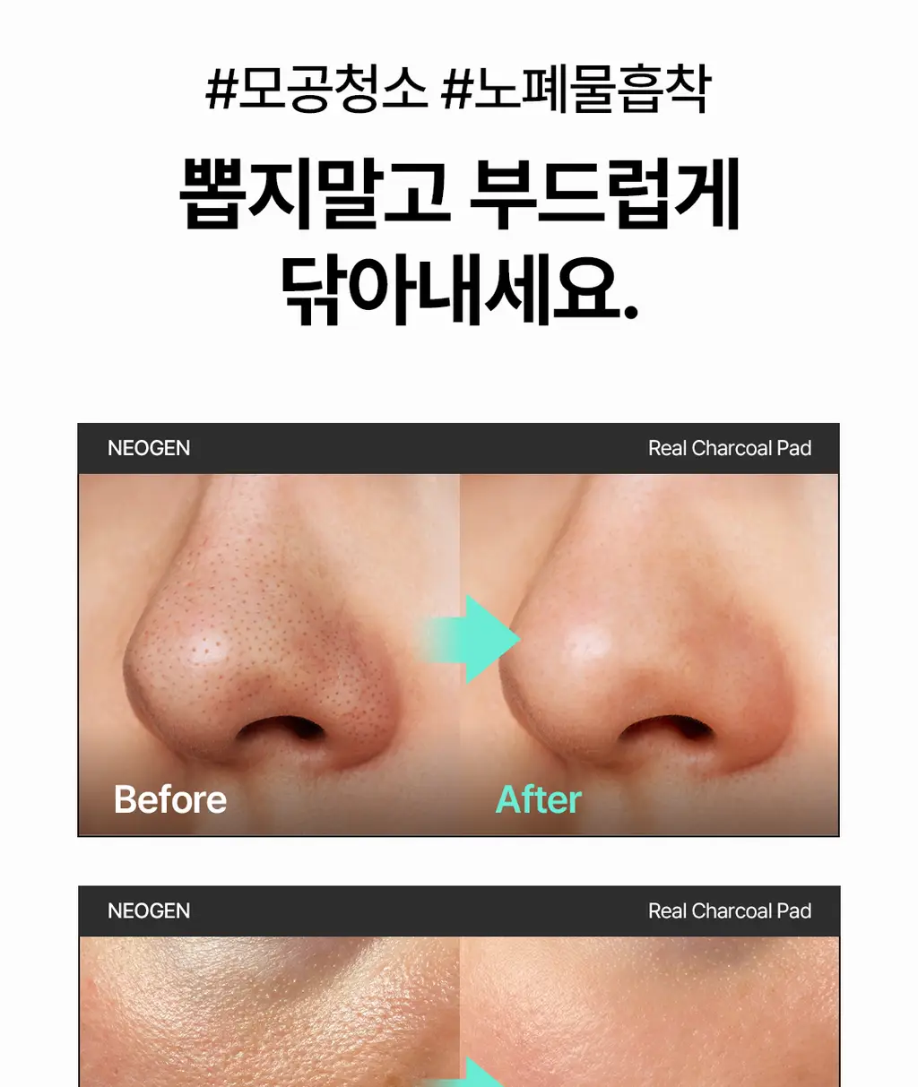 [모공청소/피지&각질&블랙헤드 쓱-싹] 네오젠 리얼 참숯 토너 패드 60매 상세페이지 7